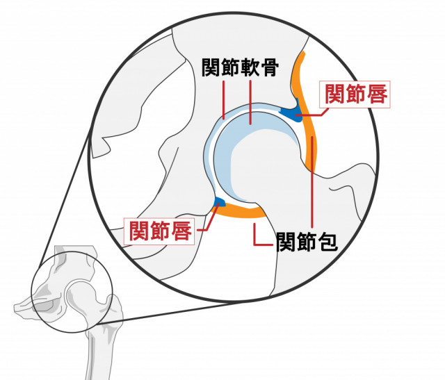変形性股関節症で大切にしていること